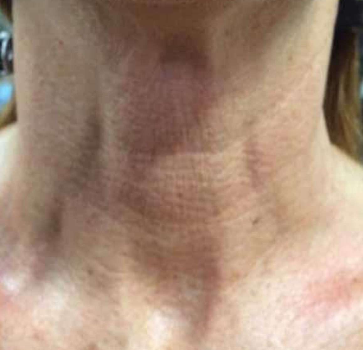 Photo après séances de Twin Slim