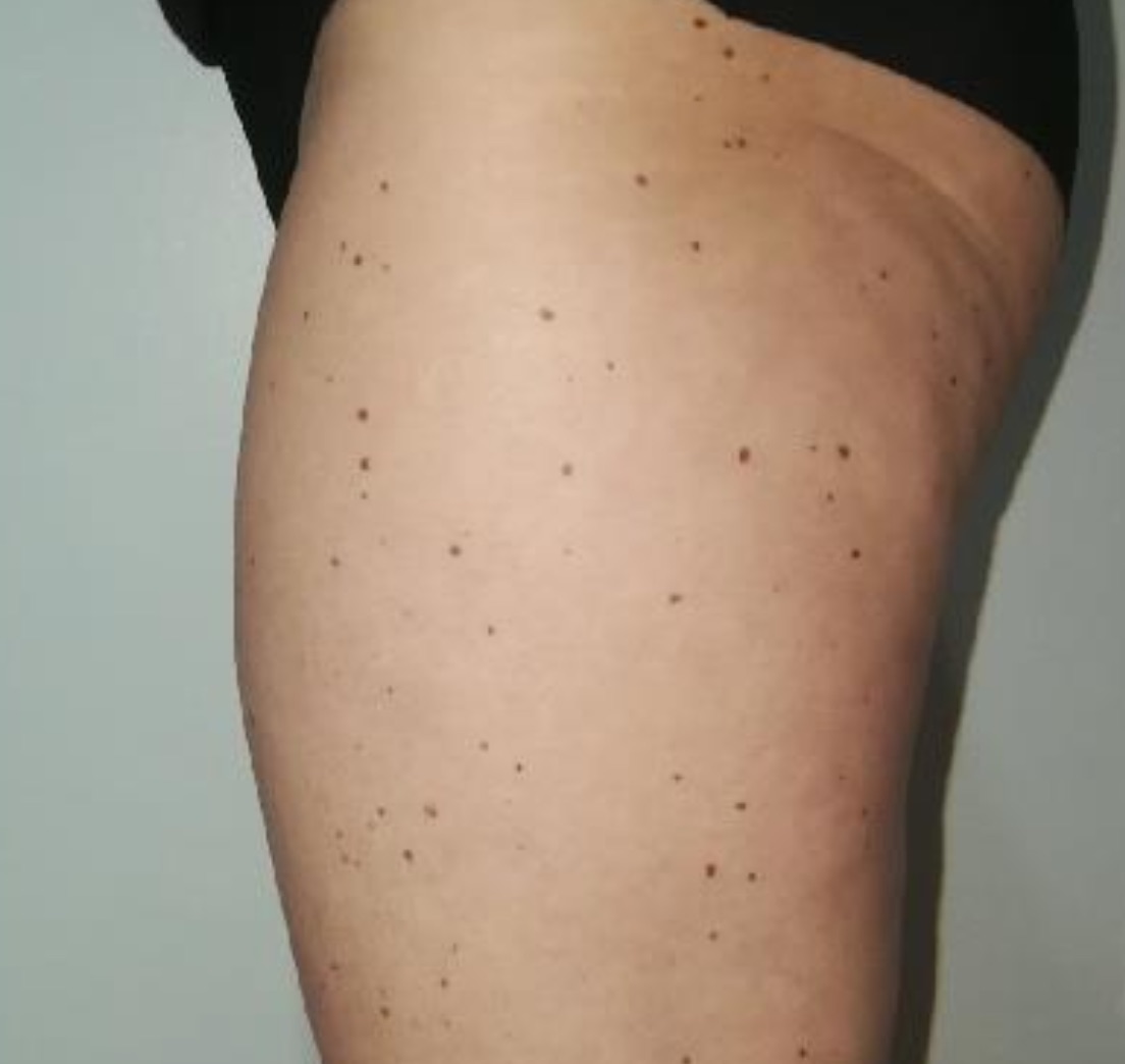 Photo après séances de Twin Slim