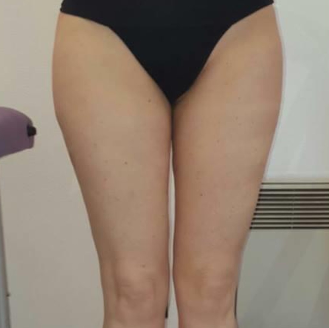 Photo après séances de Twin Slim