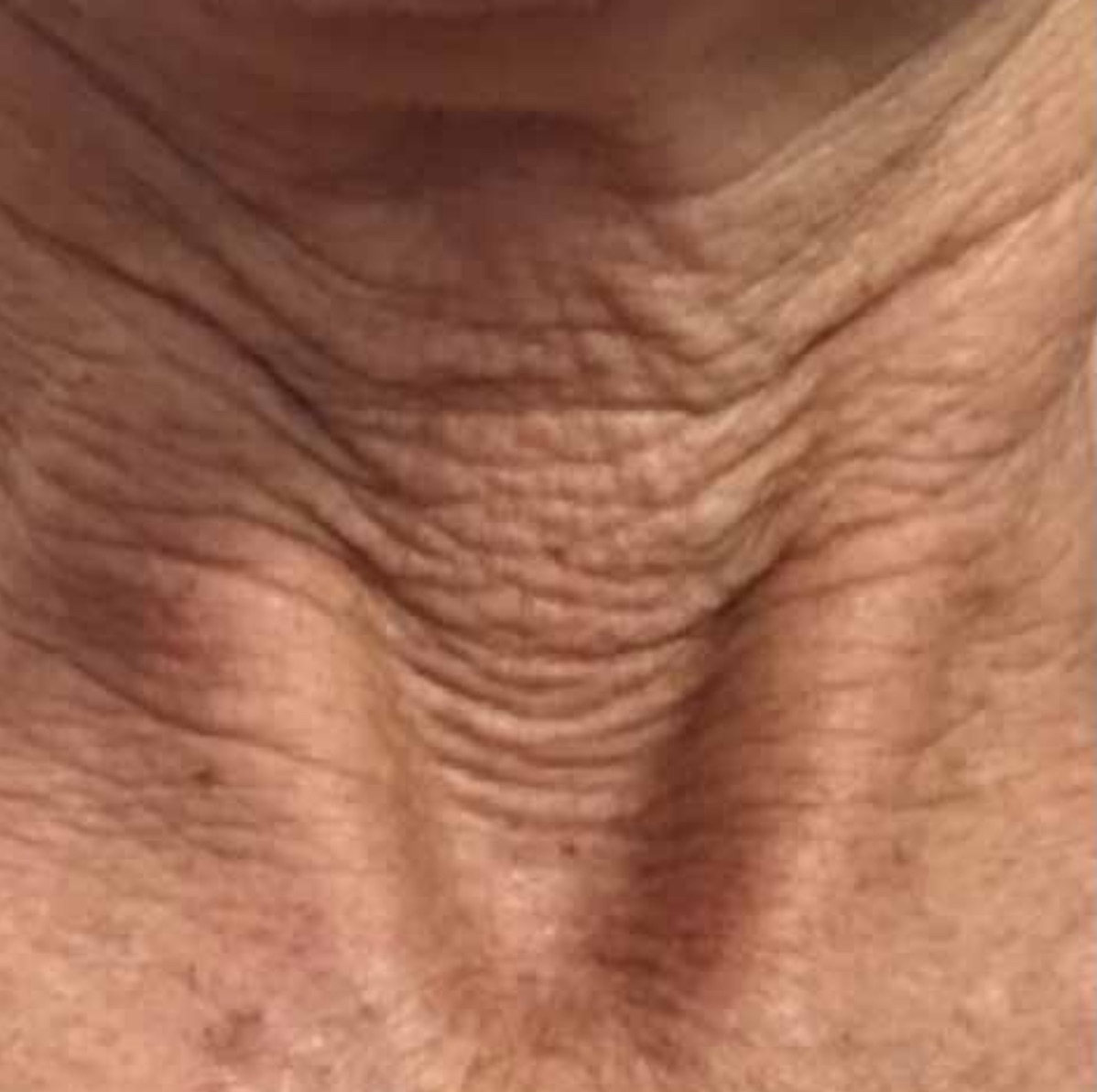 Photo avant séances de Twin Slim