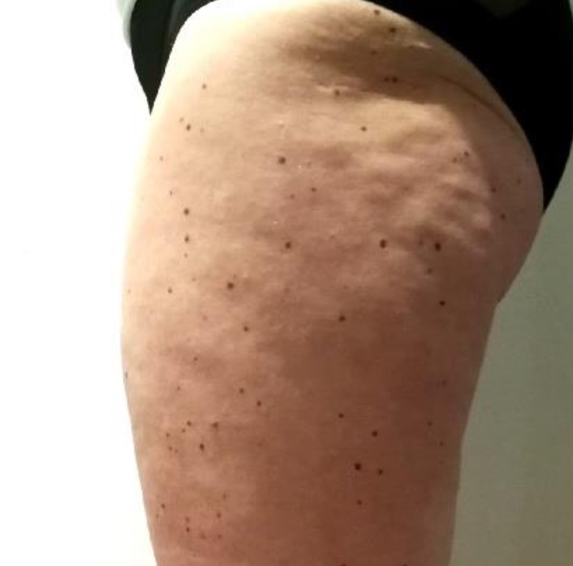 Photo avant séances de Twin Slim