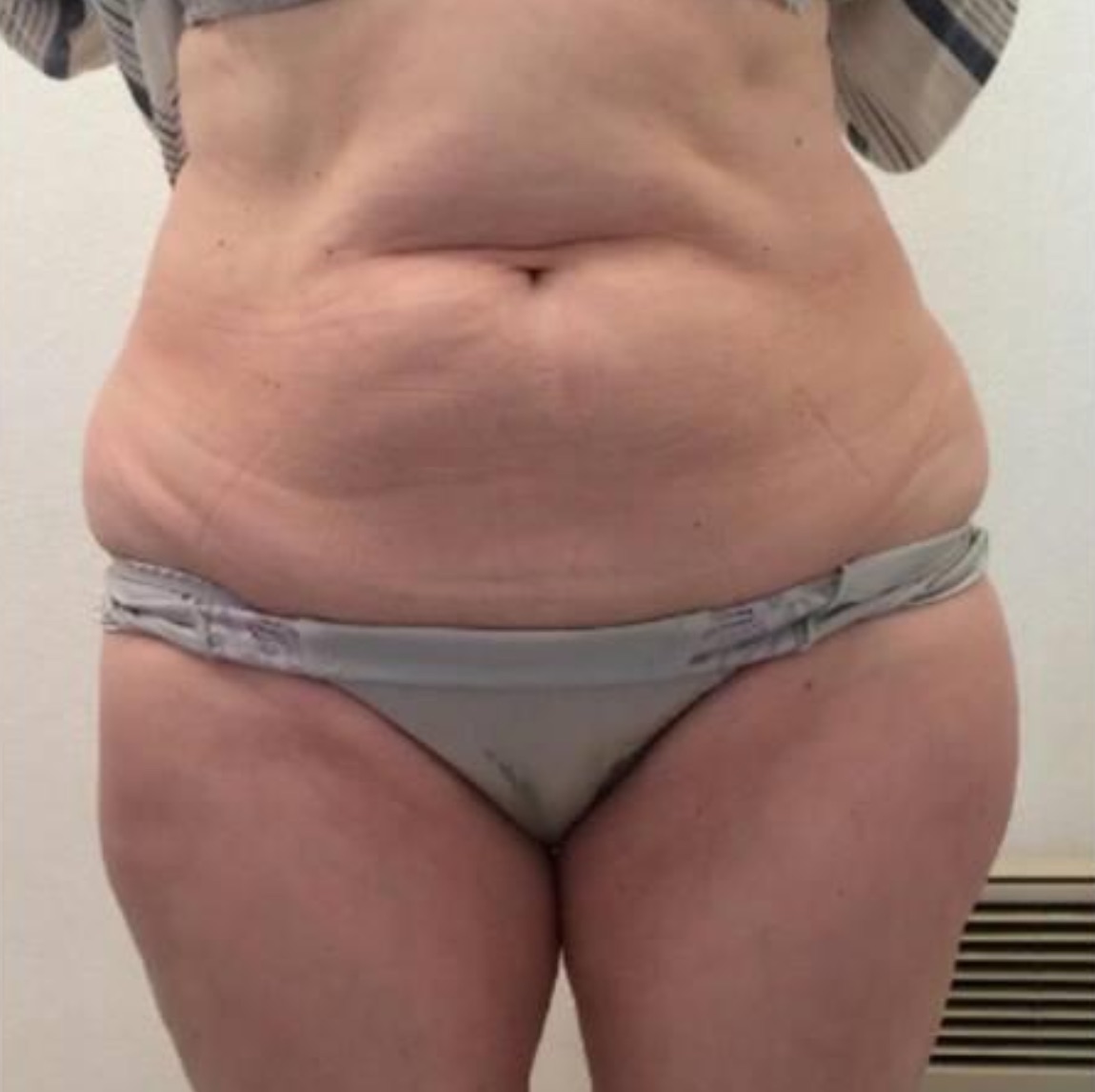 Photo avant séances de Twin Slim